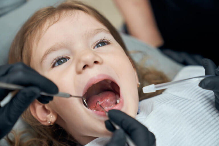 Tooth decay (cavities) in children