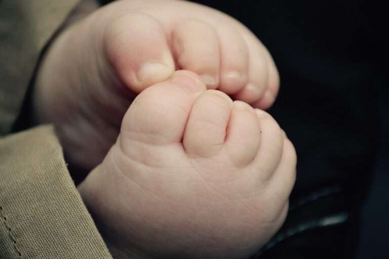 Ingrown toenails in children