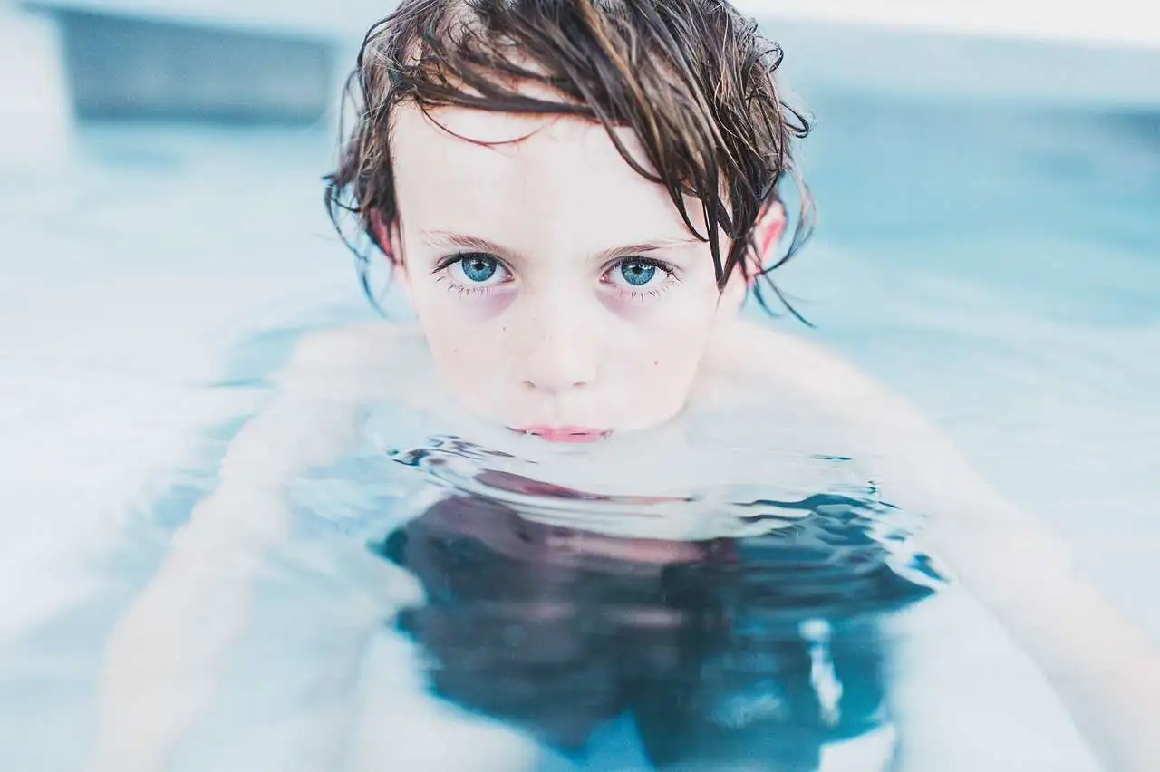 Congenital Myopathies Congenital Myopathies